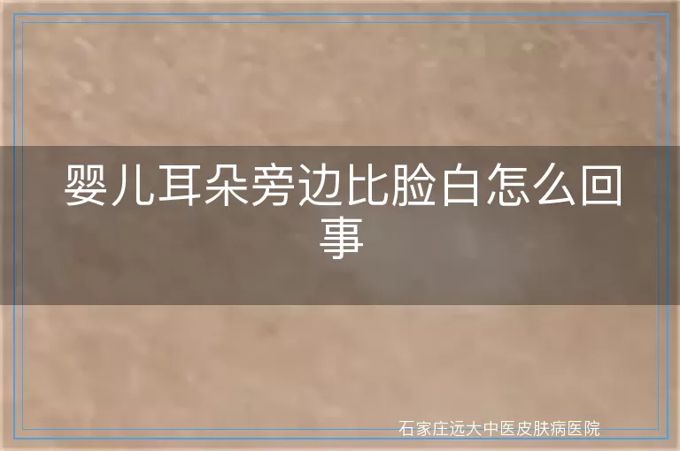 婴儿耳朵旁边比脸白怎么回事