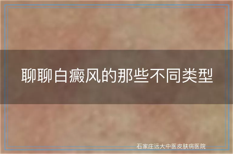 聊聊白癜风的那些不同类型