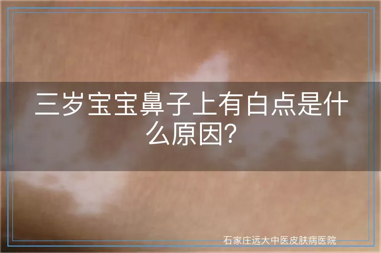 三岁宝宝鼻子上有白点是什么原因？