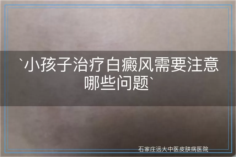 小孩子治疗白癜风需要注意哪些问题