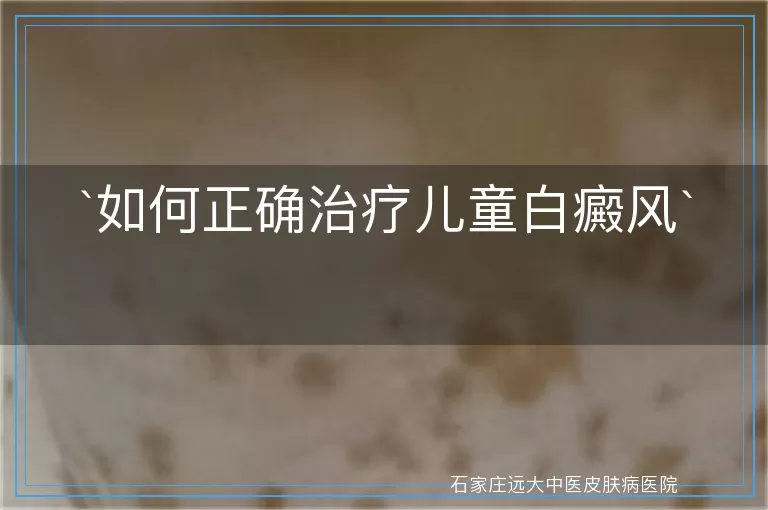 如何正确治疗儿童白癜风