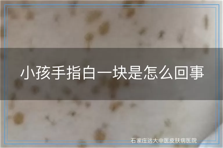 小孩手指白一块是怎么回事