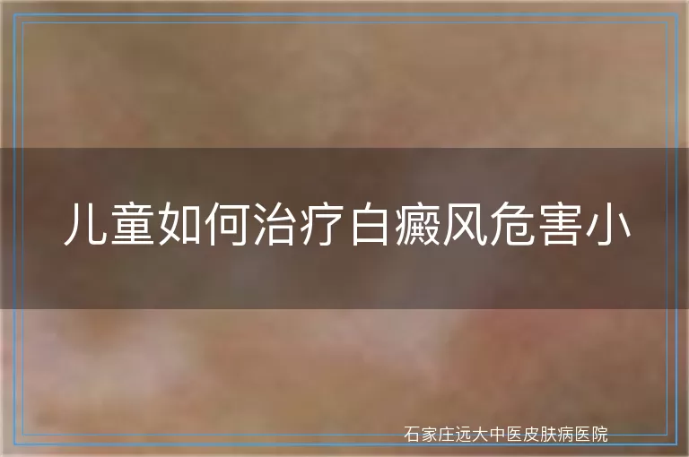儿童如何治疗白癜风危害小