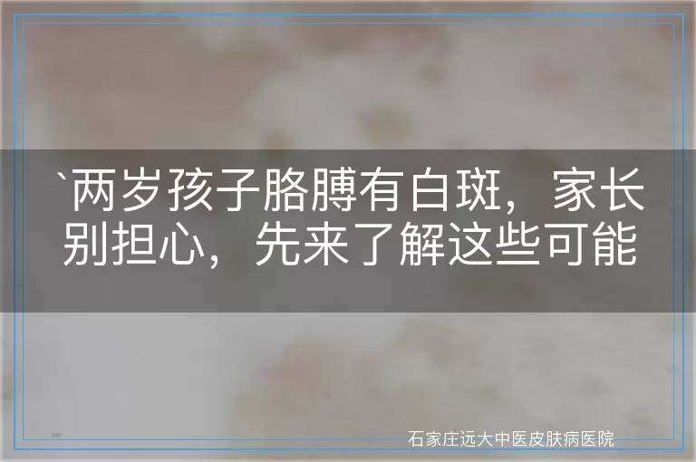 两岁孩子胳膊有白斑，家长别担心，先来了解这些可能的原因