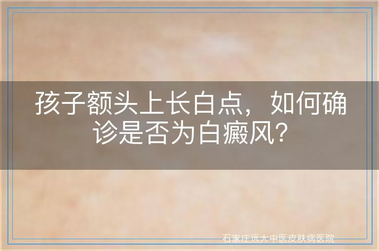 孩子额头上长白点，如何确诊是否为白癜风？