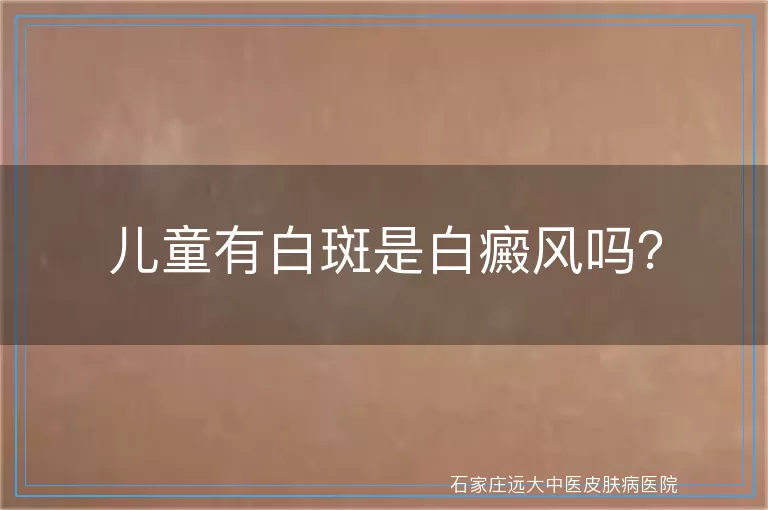 儿童有白斑是白癜风吗？