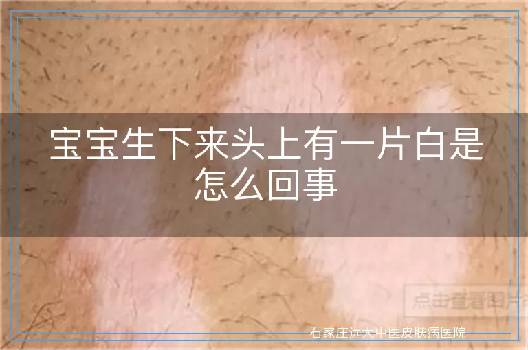 宝宝生下来头上有一片白是怎么回事