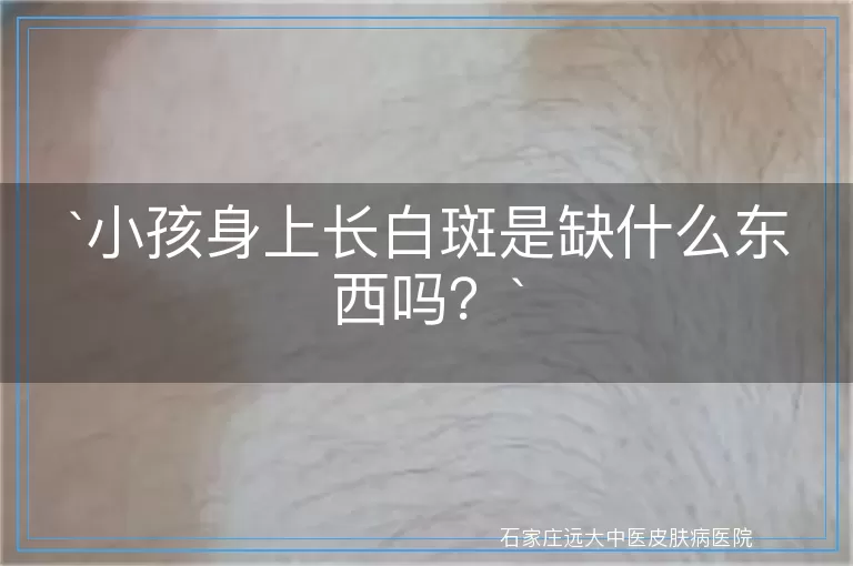 小孩身上长白斑是缺什么东西吗？