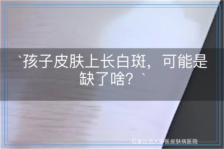孩子皮肤上长白斑，可能是缺了啥？