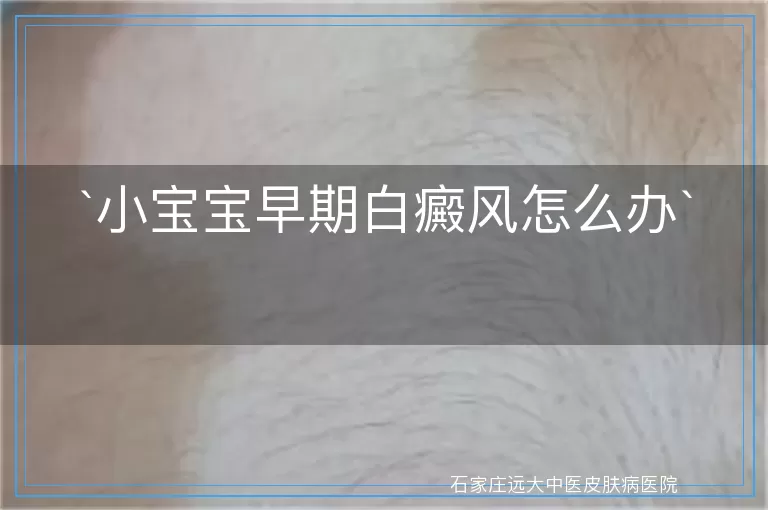 小宝宝早期白癜风怎么办