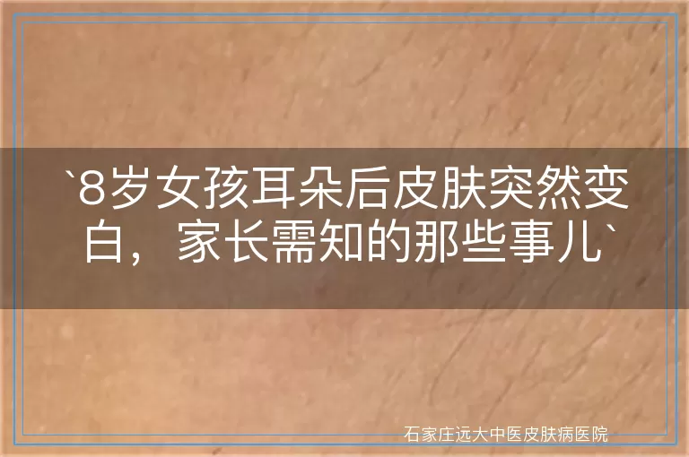 8岁女孩耳朵后皮肤突然变白，家长需知的那些事儿