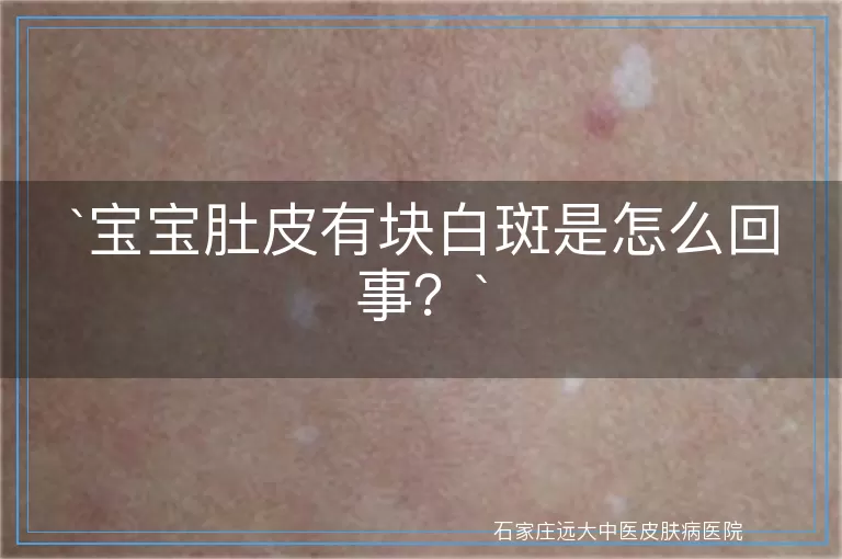 宝宝肚皮有块白斑是怎么回事？