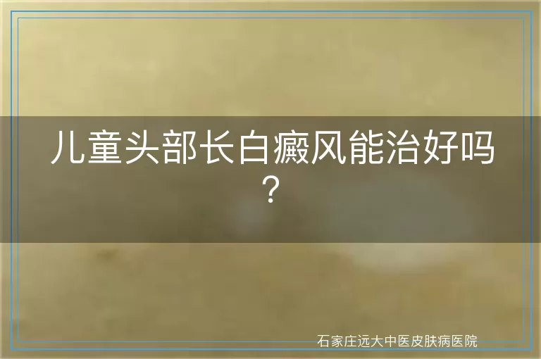 儿童头部长白癜风能治好吗？