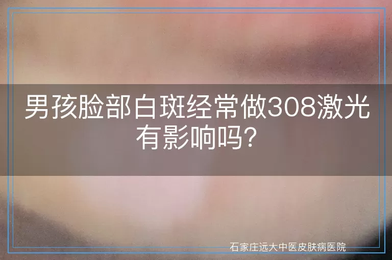男孩脸部白斑经常做308激光有影响吗？