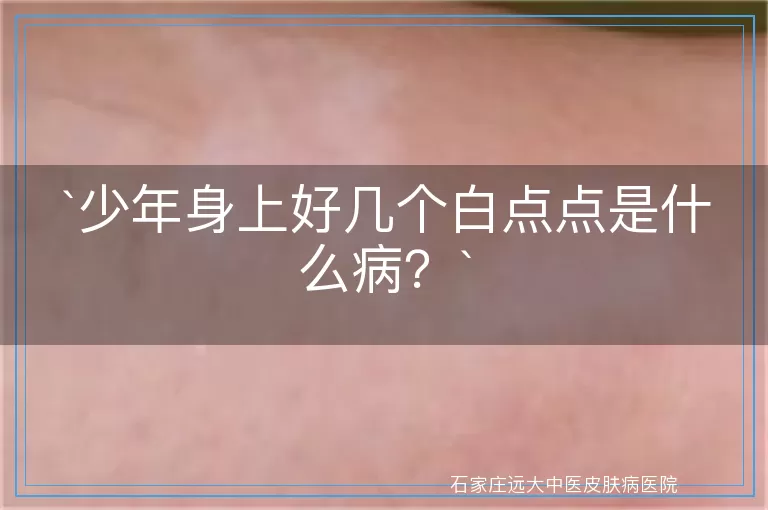 少年身上好几个白点点是什么病？