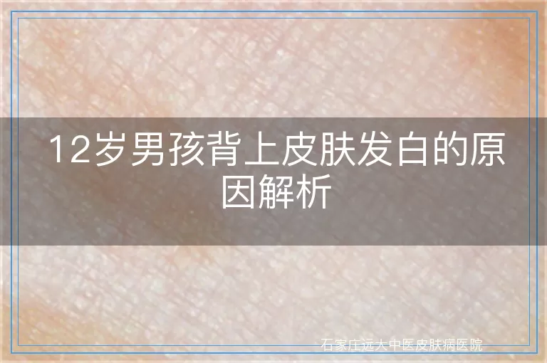 12岁男孩背上皮肤发白的原因解析