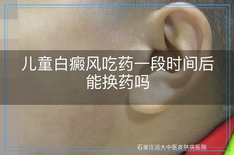 儿童白癜风吃药一段时间后能换药吗