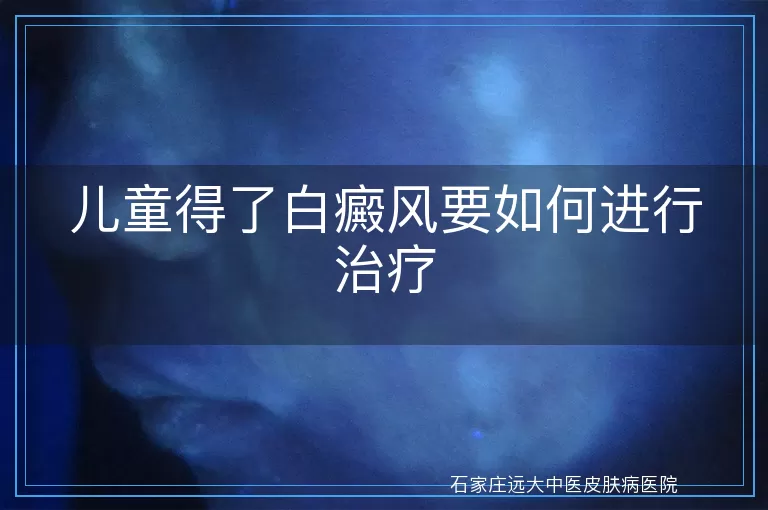 儿童得了白癜风要如何进行治疗