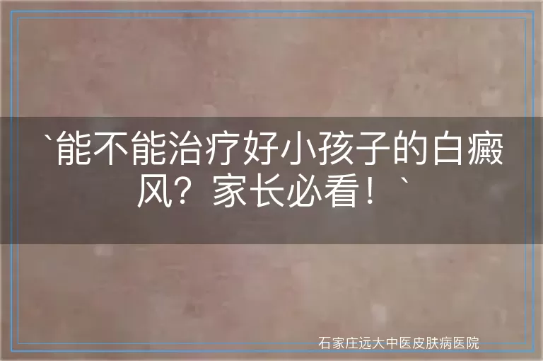 能不能治疗好小孩子的白癜风？家长必看！