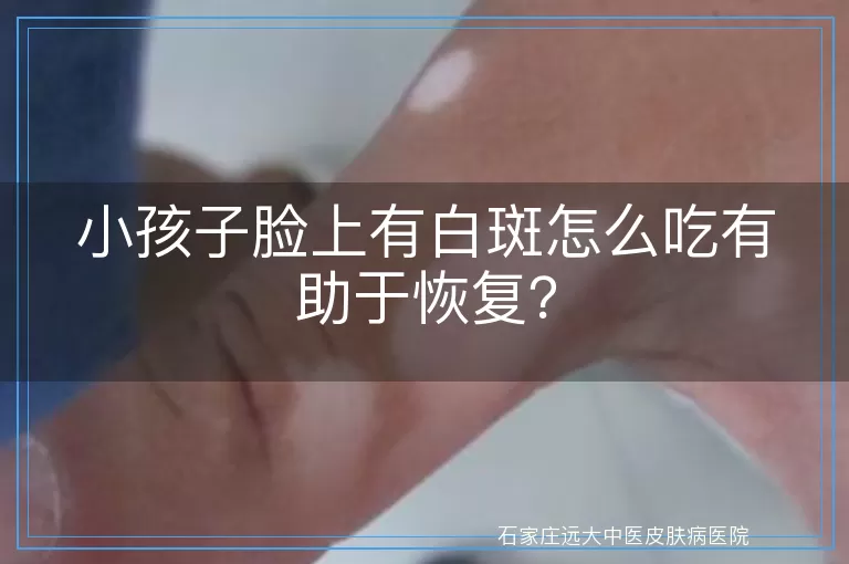 小孩子脸上有白斑怎么吃有助于恢复？