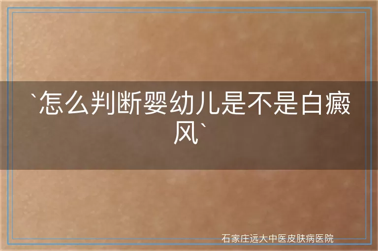 怎么判断婴幼儿是不是白癜风