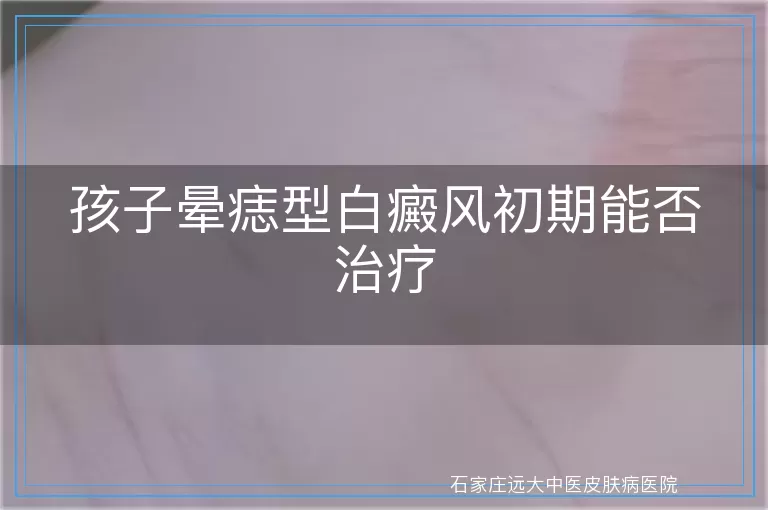 孩子晕痣型白癜风初期能否治疗