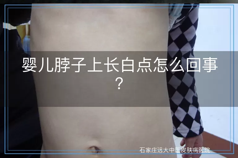 婴儿脖子上长白点怎么回事？