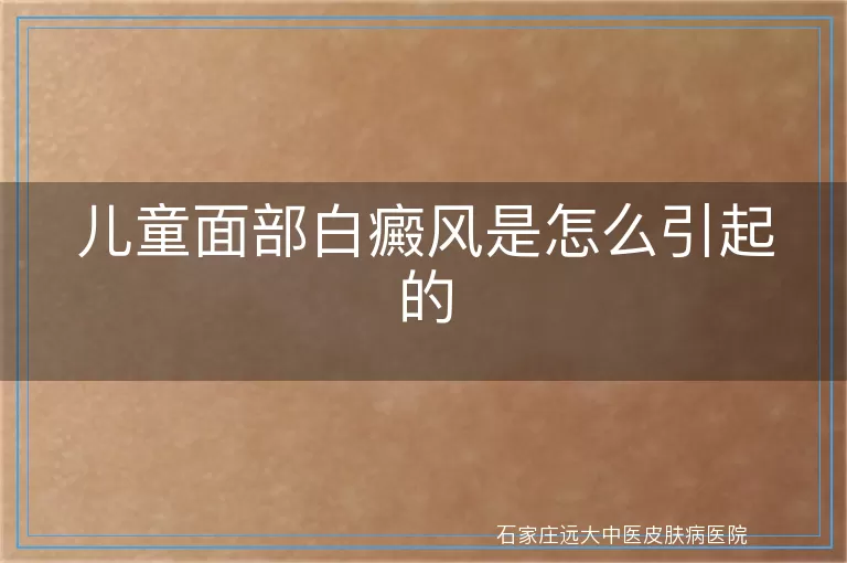儿童面部白癜风是怎么引起的