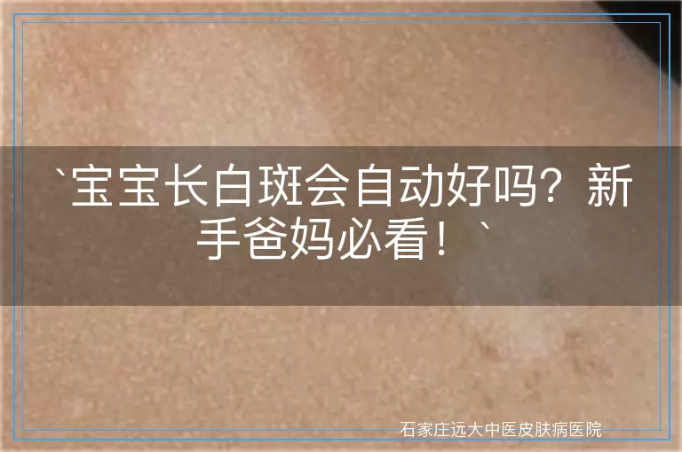 宝宝长白斑会自动好吗？新手爸妈必看！