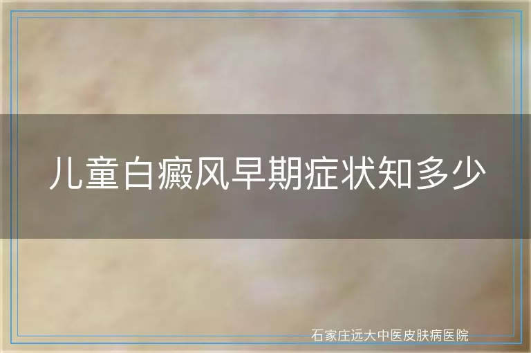 儿童白癜风早期症状知多少