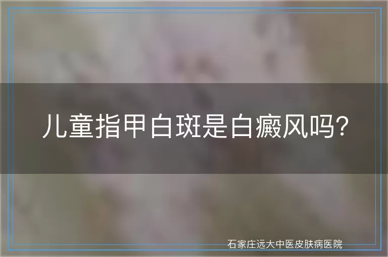 儿童指甲白斑是白癜风吗？