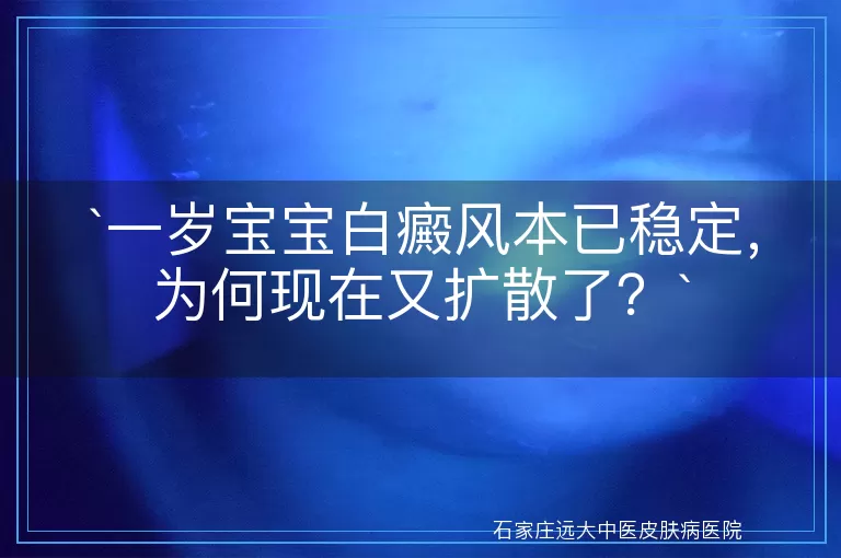 一岁宝宝白癜风本已稳定，为何现在又扩散了？