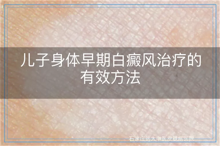 儿子身体早期白癜风治疗的有效方法
