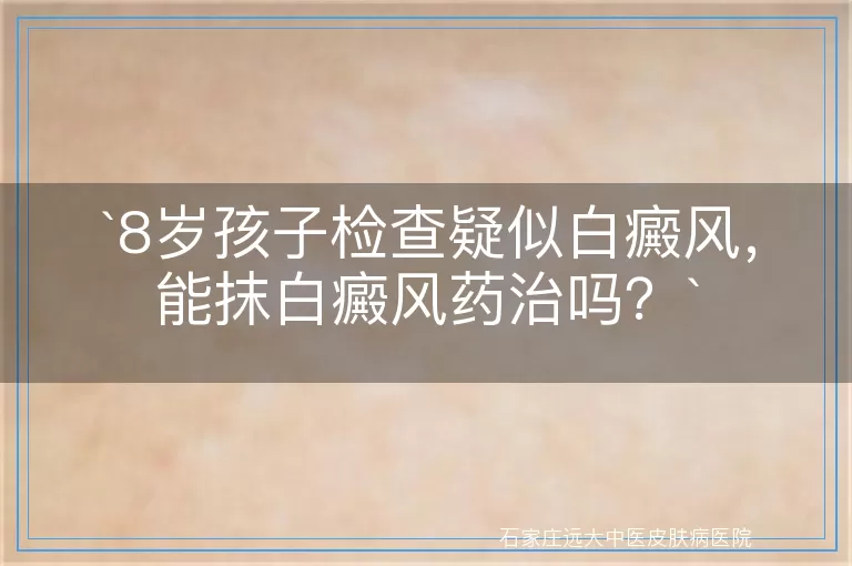 8岁孩子检查疑似白癜风，能抹白癜风药治吗？
