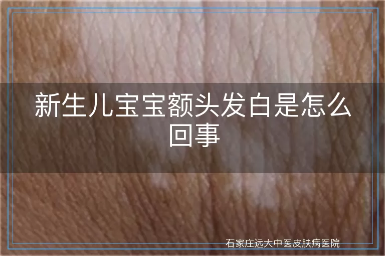 新生儿宝宝额头发白是怎么回事