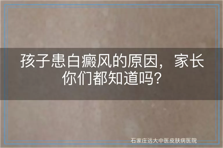 孩子患白癜风的原因，家长你们都知道吗？