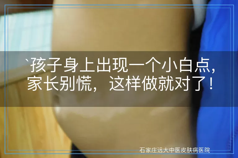 孩子身上出现一个小白点，家长别慌，这样做就对了！