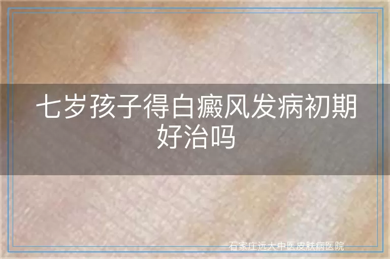 七岁孩子得白癜风发病初期好治吗