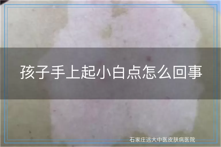 孩子手上起小白点怎么回事