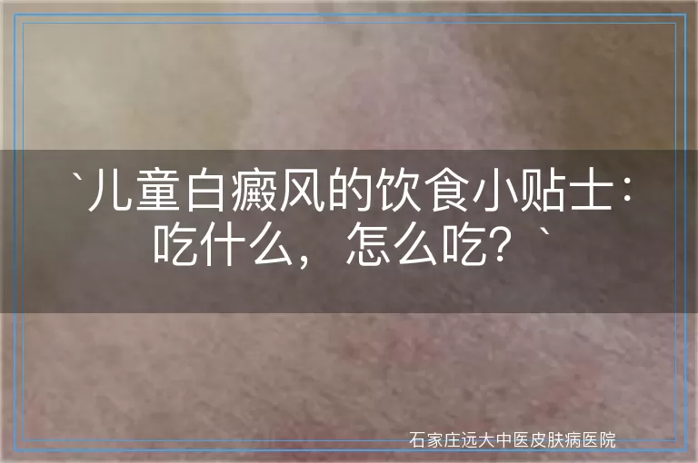 儿童白癜风的饮食小贴士：吃什么，怎么吃？