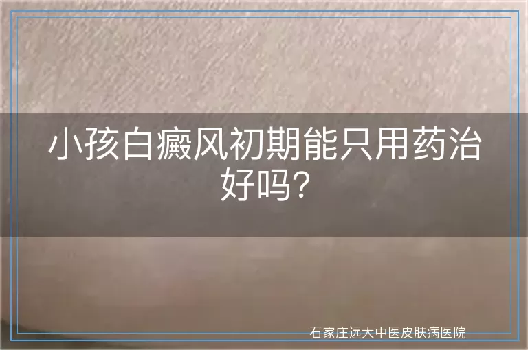 小孩白癜风初期能只用药治好吗？