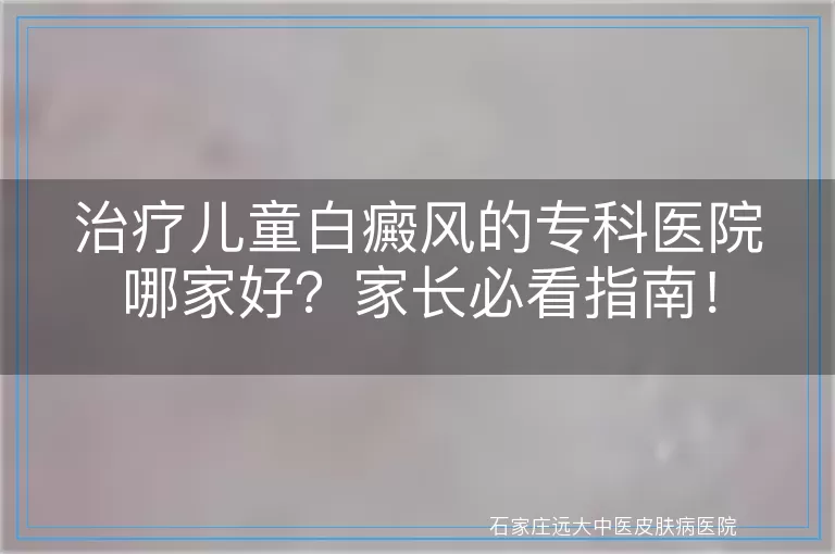 治疗儿童白癜风的专科医院哪家好？家长必看指南！
