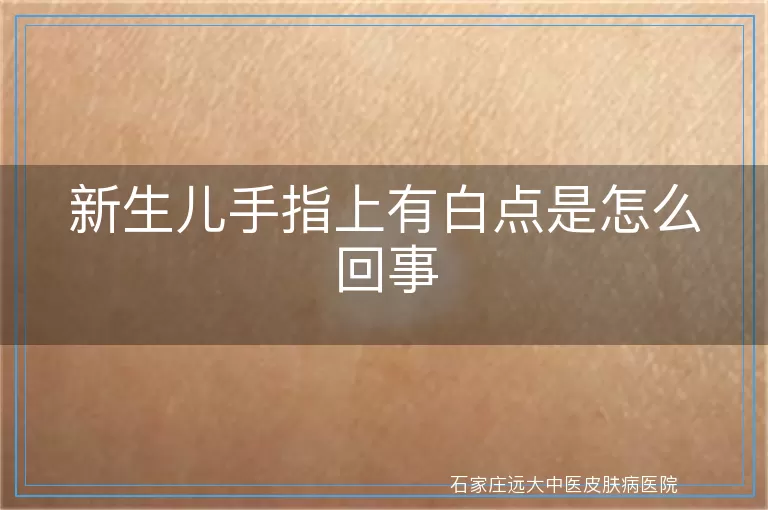 新生儿手指上有白点是怎么回事