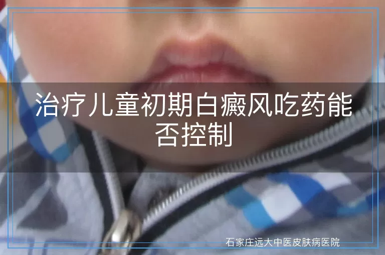 治疗儿童初期白癜风吃药能否控制