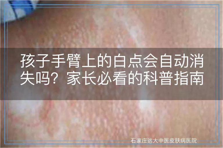 孩子手臂上的白点会自动消失吗？家长必看的科普指南