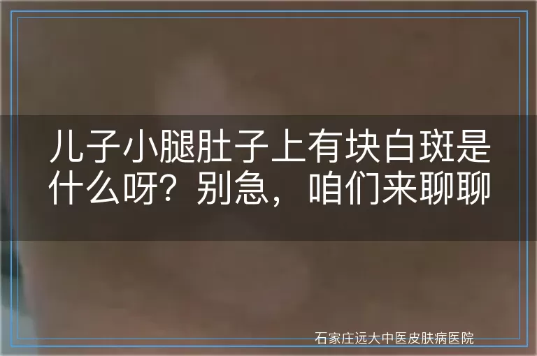 儿子小腿肚子上有块白斑是什么呀？别急，咱们来聊聊