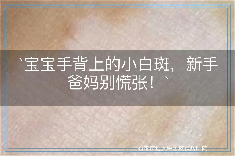 宝宝手背上的小白斑，新手爸妈别慌张！