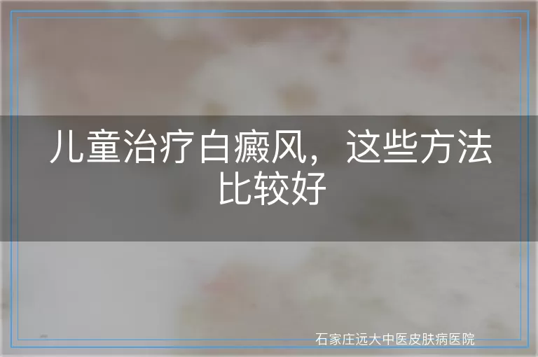 儿童治疗白癜风，这些方法比较好