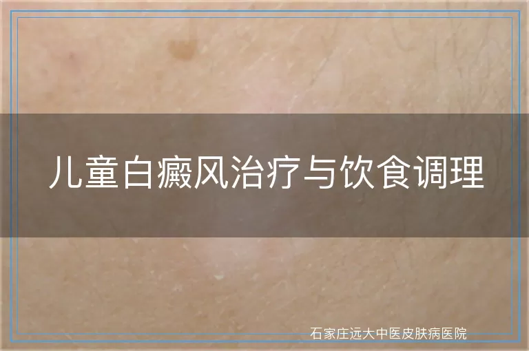 儿童白癜风治疗与饮食调理