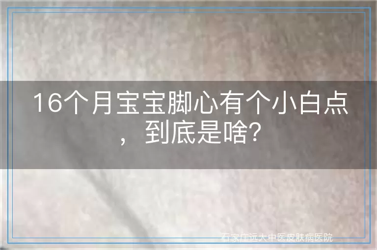 16个月宝宝脚心有个小白点,到底是啥?